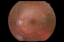 bdrlaser_nira_281729.png