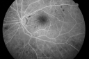 bdrlaser_nira_28629.png