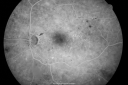 bdrlaser_nira_28929.png