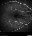 brvo_ilays_051823_13.jpg