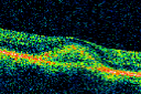 brvoandpatterndyst_jsm09.png