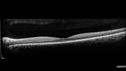 cat-scratch-bemo-041818_2weekfu_38.jpg