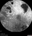 choreremiacarrier_makl_011215_29.jpg
