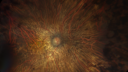 choroideremia_datib_061319_01-cropped.png