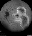 chronic-csr-laco-113017_001.jpg