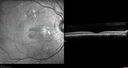 chronic-csr-laco-113017_004001.jpg