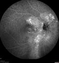 chronic-csr-laco-113017_005.jpg