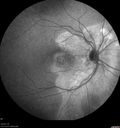 chronic-csr-laco-113017_006.jpg