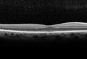 cme1_trav_dedo_010517_05.jpg