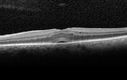 cme1_trav_dedo_010517_07.jpg
