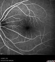 cme1_trav_dedo_010517_11.jpg