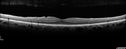 cme2_trav_dedo_020817_19.jpg