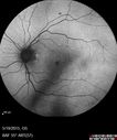 cme_anle_051915_06.jpg