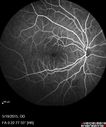 cme_anle_051915_13.jpg