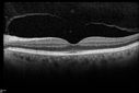 cme_dosm_081114_09.jpg