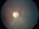 cme_roen_08281502.png