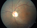 cme_roen_08281504.png