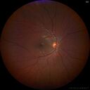 coloboma_jacal_03.jpg