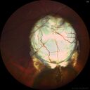 coloboma_jacal_06.jpg