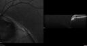coloboma_jacal_12.jpg