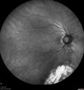 coloboma_nawei_06.jpg