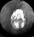 coloboma_nawei_09.jpg