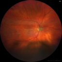 coloboma_sther_2019_01.png
