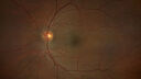 commotio_108340_092121_02.jpg