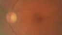 cone-dyst_aylboi_041819_03.JPG