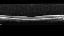 cone-dyst_aylboi_041819_12.jpg