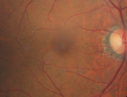 conedyst_arbu_120816_01.png