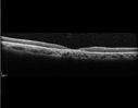 conedyst_arbu_120816_10.jpg