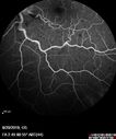 crvo_glpe_082018_24.jpg