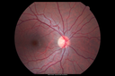 crvo_mabr_050415_02.png