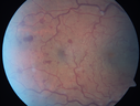crvo_memi_081115_04.png
