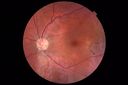 csr-OS-asymptomatic-goodva_28529.JPG