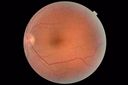 csr-chronic_davden_041819_03.JPG