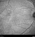 csr-chronic_davden_041819_05.jpg
