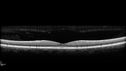 csr-chronic_davden_041819_08.jpg