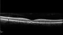 csr-chronic_davden_041819_10.jpg