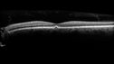 csr-chronic_davden_041819_11.jpg