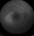 csr-chronic_davden_041819_14.jpg