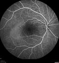 csr-chronic_davden_041819_16.jpg
