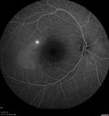 csr-chronic_davden_041819_19.jpg