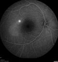 csr-chronic_davden_041819_20.jpg