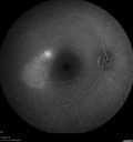 csr-chronic_davden_041819_21.jpg