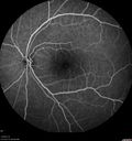 csr-chronic_davden_041819_22.jpg