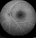 csr-chronic_davden_041819_23.jpg