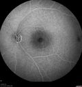 csr-chronic_davden_041819_24.jpg