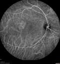 csr-chronic_davden_041819_26.jpg